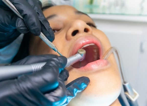 Why Should You Choose Dental Retreat for the Best Dental Implants Service in West Bengal?