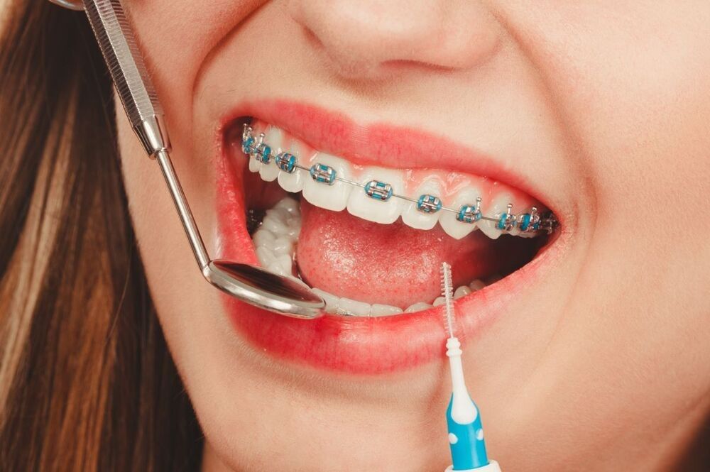 What advanced technology is used for the Best Dental Treatment in Siliguri at Dental Retreat?