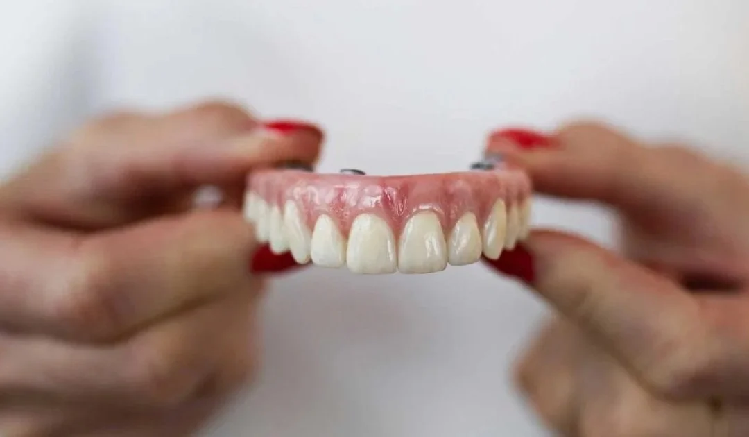 What makes Dental Retreat the Best Prosthodontist Clinic in Sikkim for smile rehabilitation?