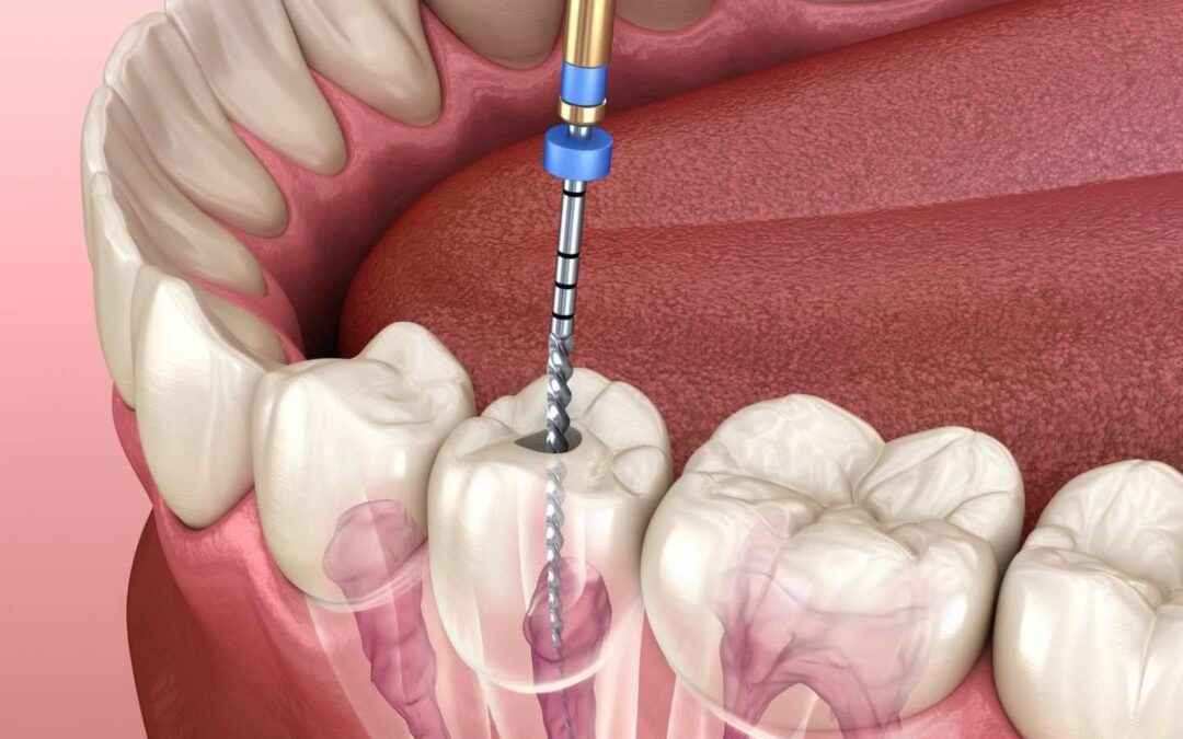 How can the Best Dental Treatment in Siliguri improve oral health and smile appearance?