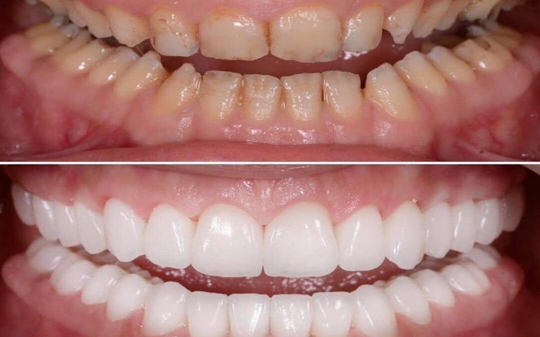 What technologies are used in Best Full Mouth Rehabilitation in Gangtok at Dental Retreat?
