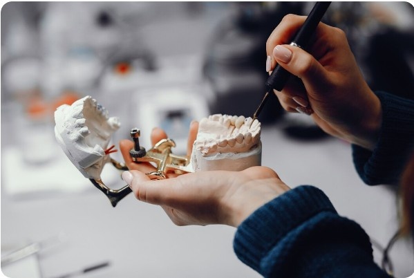What Are the Benefits of Dental Implants Compared to Removable Dentures?